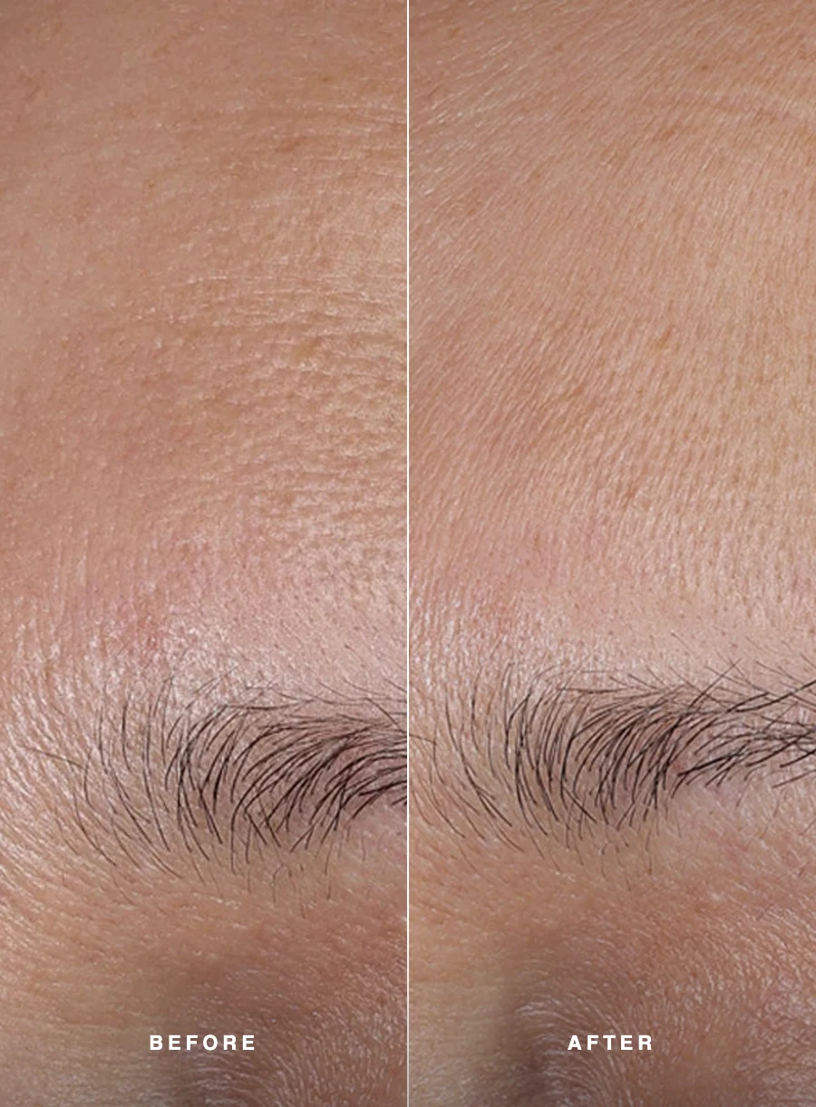 Augustinus Bader The Overnight Restorative Cream – before and after