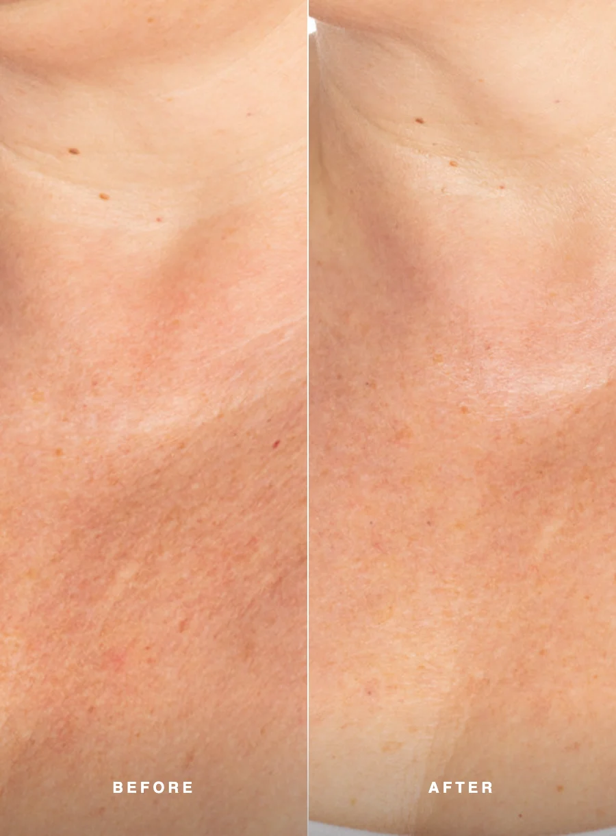 Augustinus Bader The Solar Shield SPF 50 – before and after