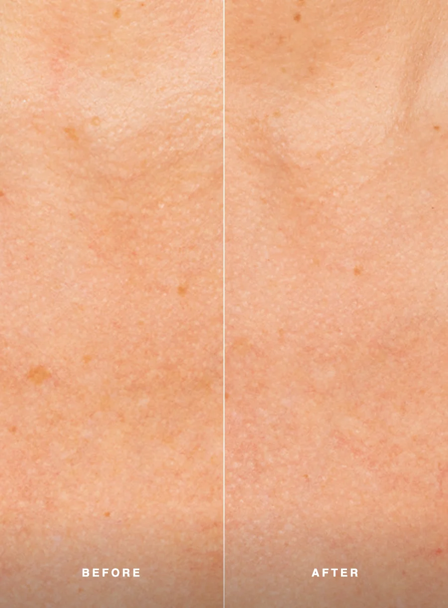 Augustinus Bader The Solar Shield SPF 50 – before and after